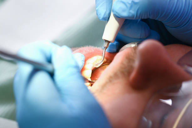 Best Emergency Treatment for Toothache in Marks, MS
