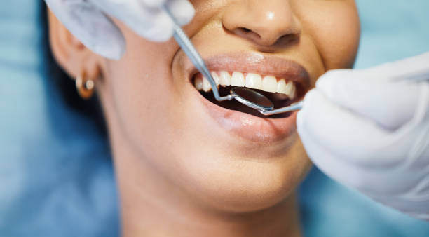 Best Emergency Tooth Extraction in Marks, MS